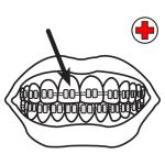 Arasaac 150-b852f7557aa410594fd17b4addd14a06